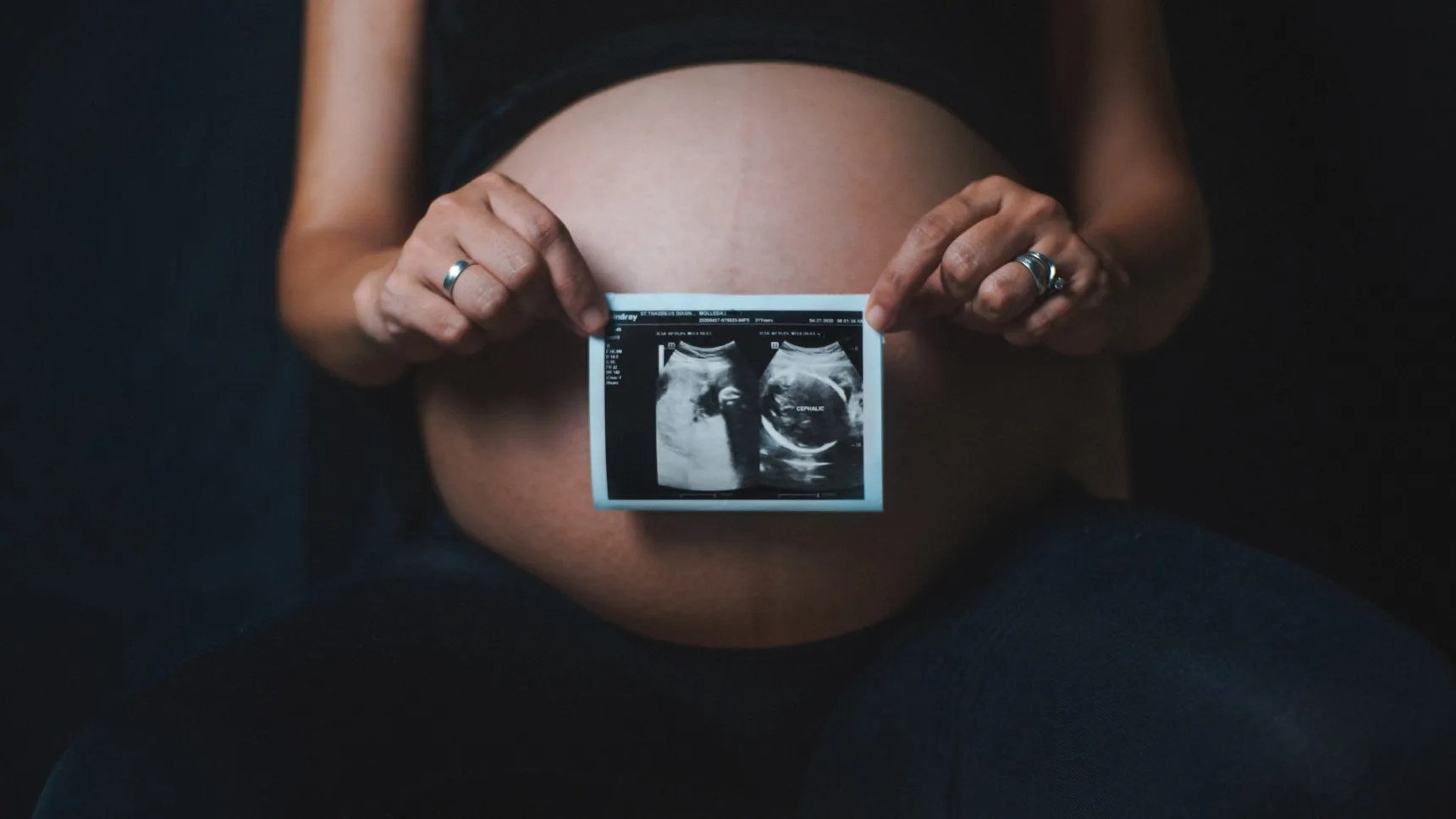 Pregnant person holding an ultrasound photo against their bump