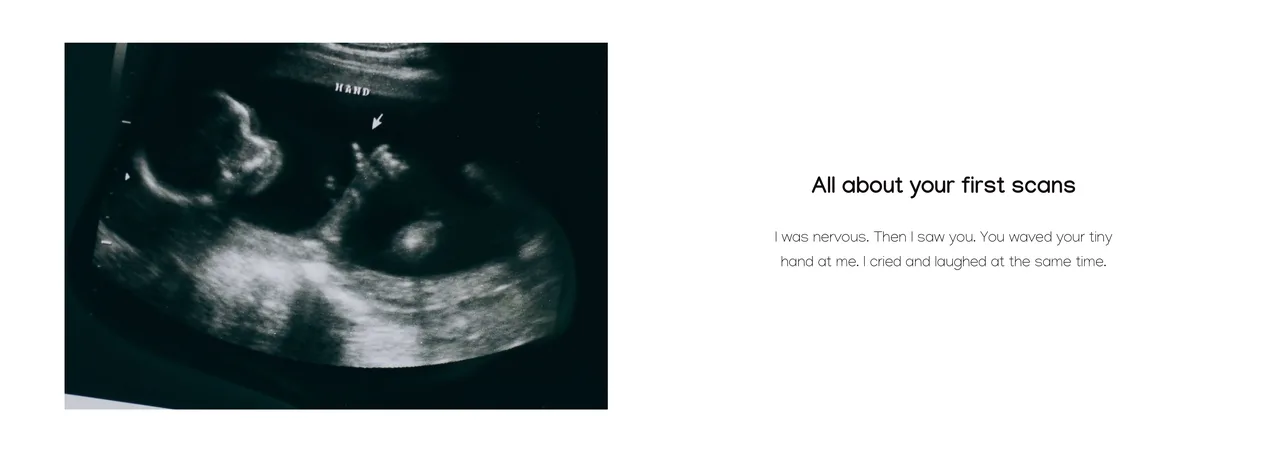 The same moment as a finished journal spread: the scan on the left page, and the heading "All about your first scans" above the reflection on the right
